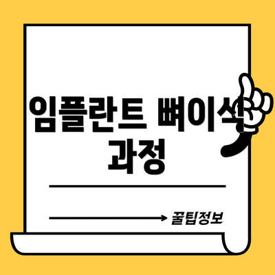 임플란트 뼈이식 과정