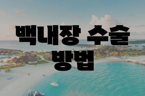 백내장 수술 방법